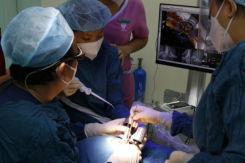 Tiến hành cấy ghép Implant với công nghệ định vị tại Nha khoa Nhân Tâm