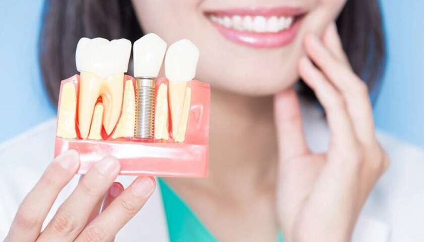 Răng Implant lành tính nên không gây khó chịu