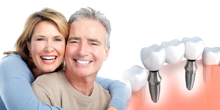 Hầu như bất kỳ ai bị mất răng đều có thể cấy ghép răng implant