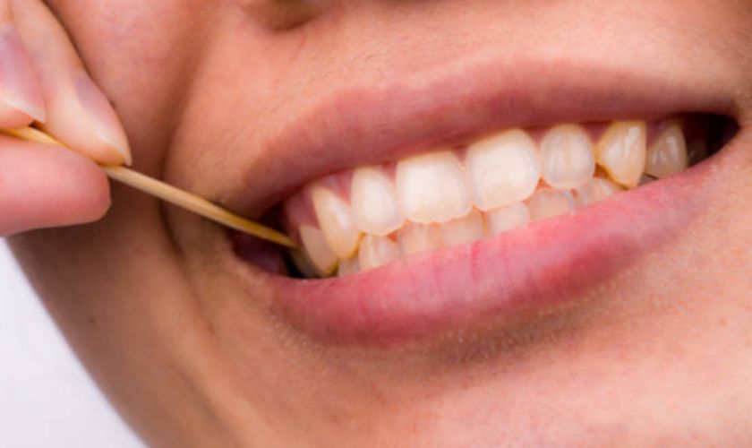 Dùng tăm xỉa răng là nguyên nhân gây ra sưng lợi răng hàm