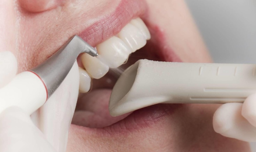 Cạo vôi răng bằng công nghệ siêu âm hiện đại